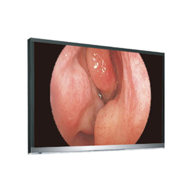 شاشة 4K UHD LCD