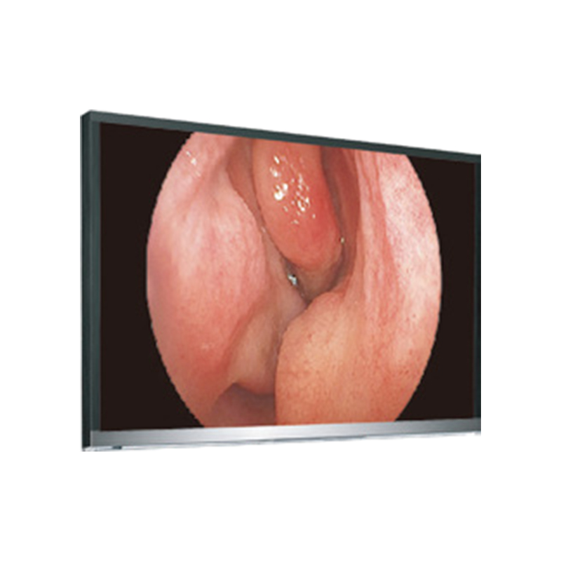 شاشة 4K UHD LCD